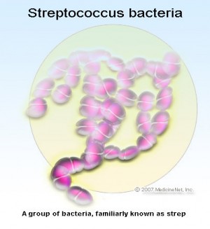 strep throat symptoms