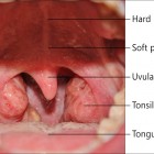 tonsils 