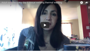 Tissue Welding Tonsillectomy recovery video blog