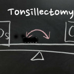 tonsillectomy pros and cons